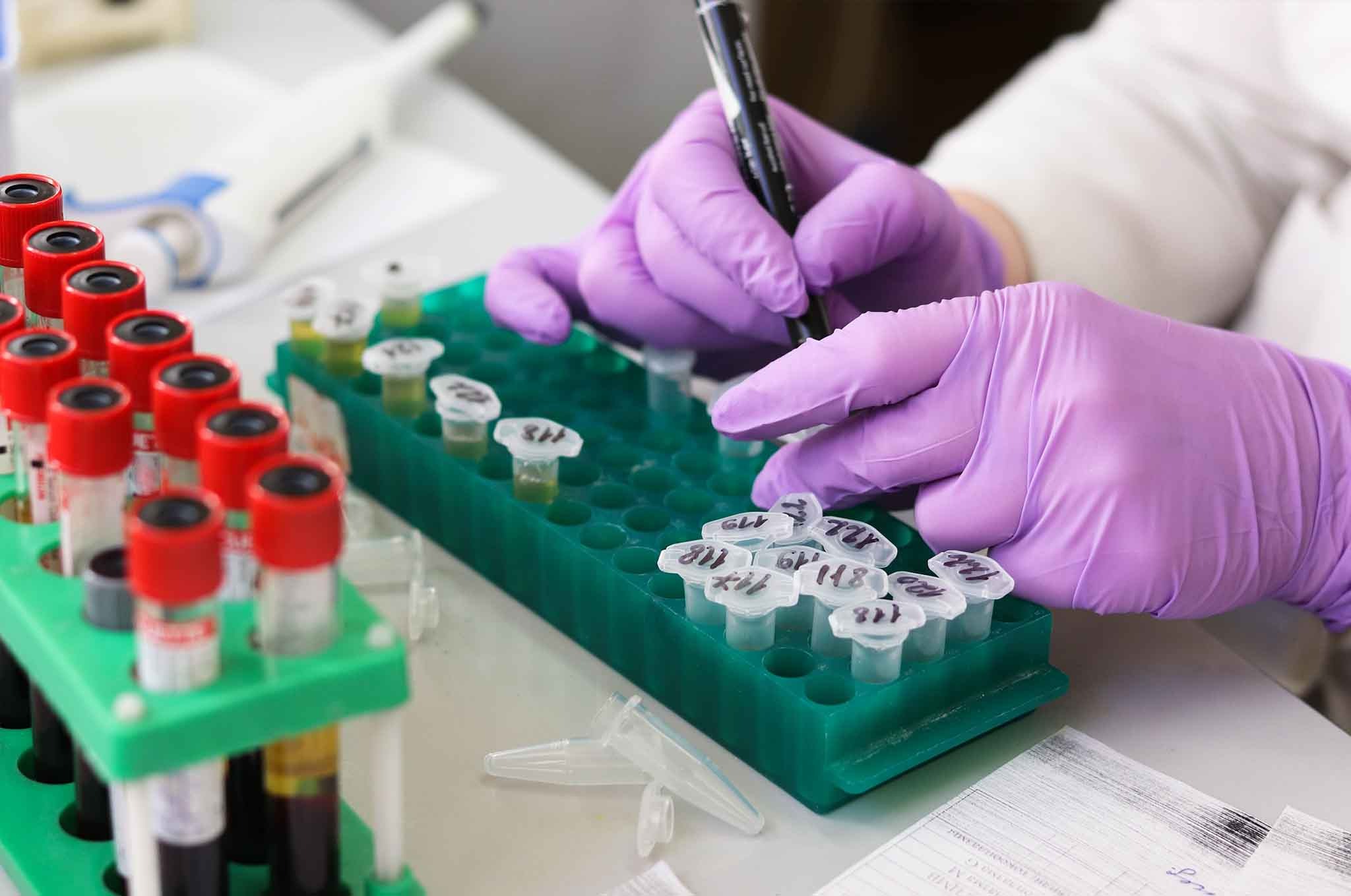 A close-up of a scientist in a lab with purple gloves doing research on a rack of substances A close-up of a scientist in a lab with purple gloves doing research on a rack of substances