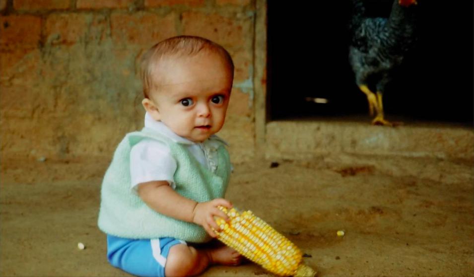 Los olvidados niños de Laron
