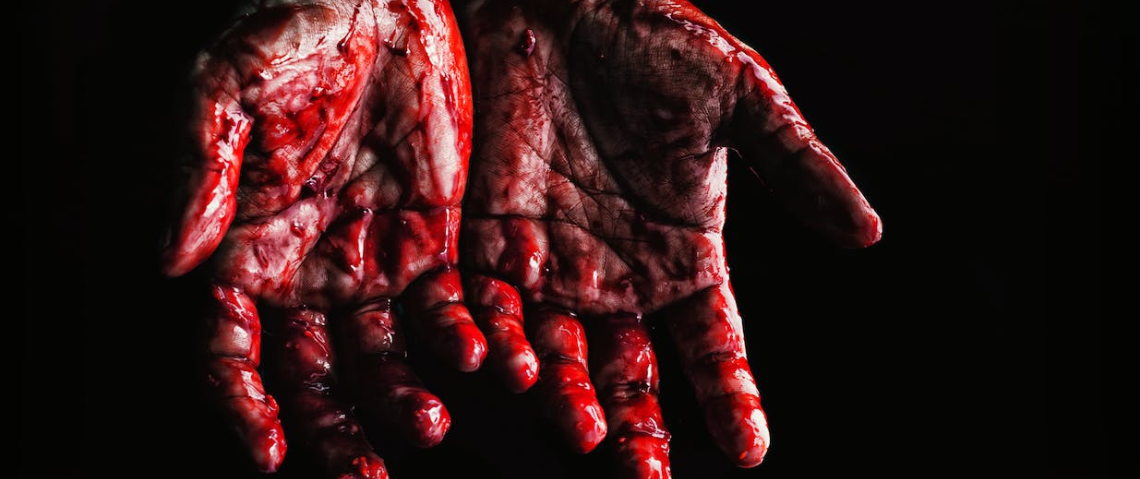 Bloody hands