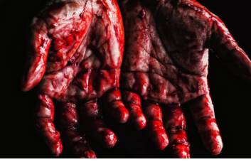 Bloody hands