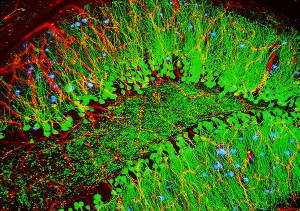 This mouse brain shows hallmarks of Alzheimer’s disease (plaques in blue), along with blood vessels (red) and nerve cells (green).