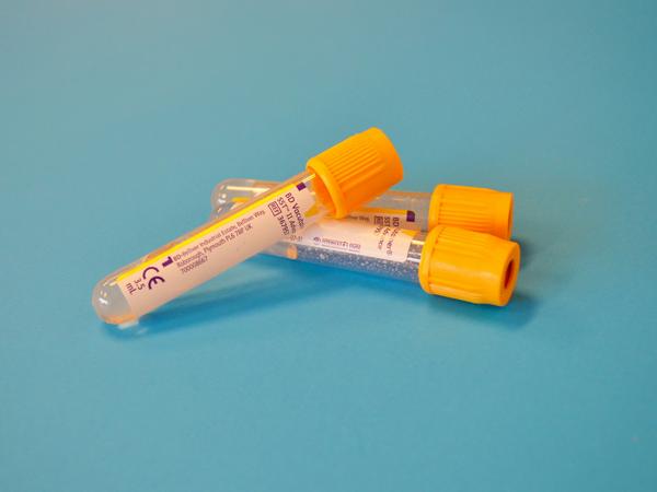 Blood collection tubes (BD Vacutainer) used for laboratory testing.